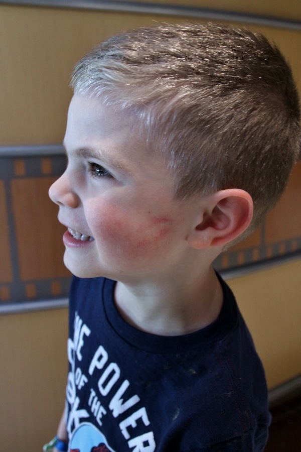 A young boy with lipstick marks on his cheek